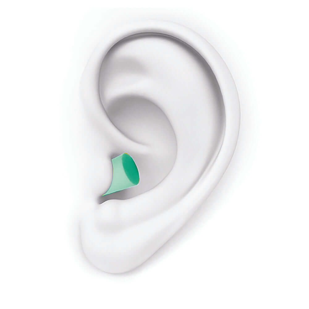 Foam sleeping earplug inserted in a model ear, showcasing its comfortable fit and high noise reduction.